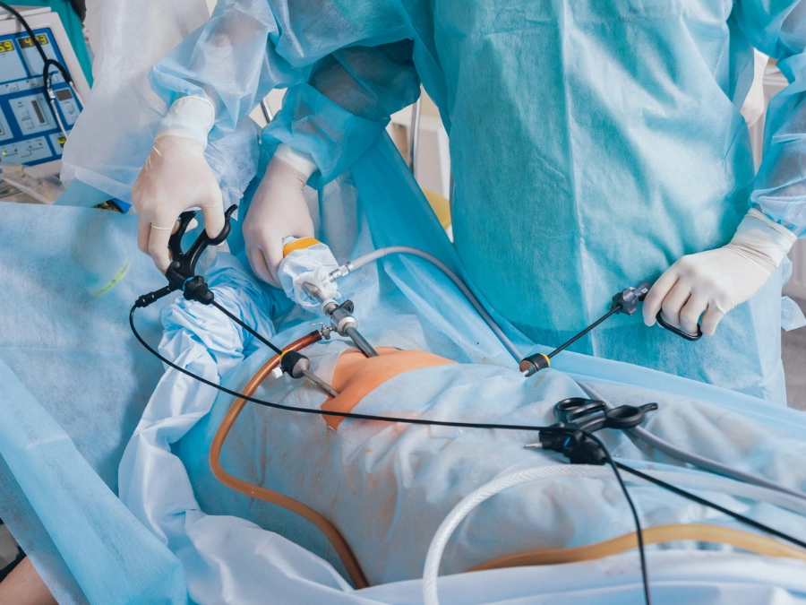 Minimally Invasive Surgeries-img01